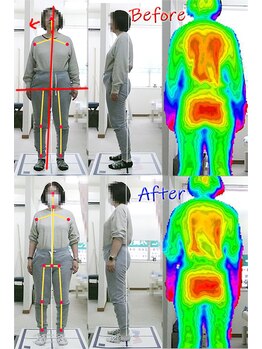 姫路なごみ整体院 なごみ鍼灸院/（改善例）慢性肩こり・首・不眠