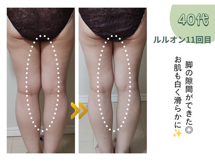 ヨサパーク ミミ 高野店(YOSA PARK mimi)の写真