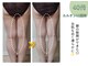ヨサパーク ミミ 高野店(YOSA PARK mimi)の写真