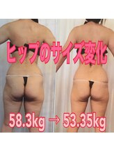 ボディエステティック アクアオーラ 富山店/５ｋｇでこの違い！