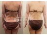 ダイエッター様必見！驚異のインド式エステ１００分！！ヘッドマッサージ付き