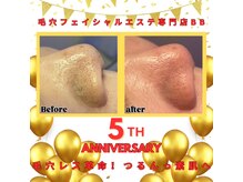ビービー(BB)