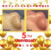 ビービー(BB)