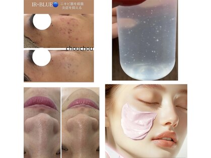 シュシュ(chou chou)の写真