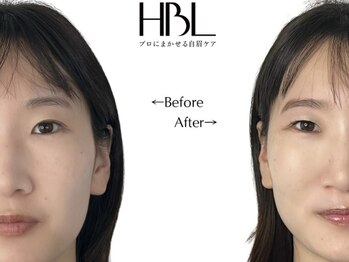 イービー(eevy.55)/《　毛が薄い人 》新HBL