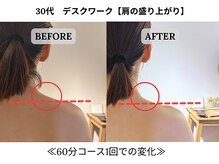 240鍼灸マッサージ院 麻布十番/１回の施術　ビフォーアフター