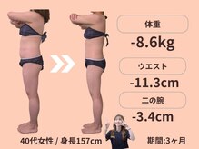 エステティックトレーニングサロン ボディネイト(Body Nate)/Before/After