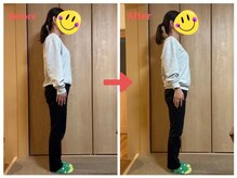 アイノテ メディカルボディケア(Ainote medical body care)/［50代女性/首・肩こり］整体