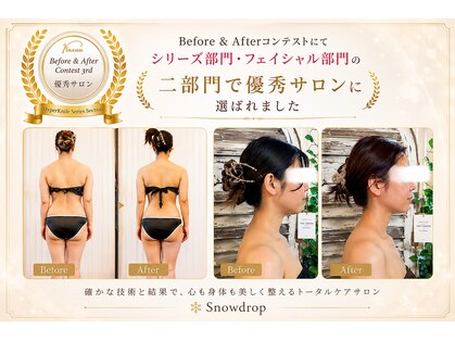 スノードロップ(Snowdrop)の写真