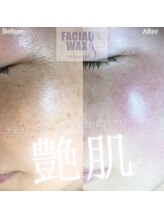 エリス(ELISSE)/フェイシャルワックスで艶肌！