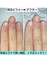 桃の木 吉祥寺店/ハンドケア＆ネイルケア