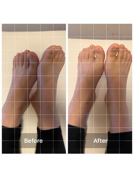 アットユウ(@yu)/フェムケア矯正