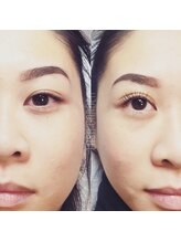 ラッシュガーデン(Lash Garden)/まつげパーマー　before & after