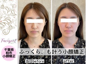 フェイシー(faceyee)/