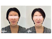 スタイルキューピット(style cupit)/メイクビフォアフター＊30代