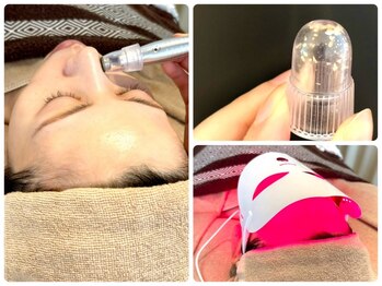 サロン アグランシュ(salon A.glansh)の写真/【毛穴角栓×プラズマ（リブセラ）¥7000）】都度払いサロン♪毛穴の詰まり・黒ずみ・角栓にアプローチ★
