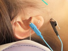 小笠原鍼灸接骨院/美容鍼［所沢/下山口］