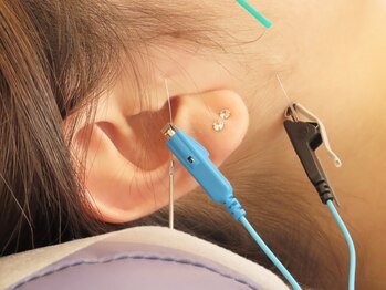 小笠原鍼灸接骨院/美容鍼［所沢/下山口］