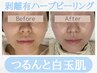 【つるんと白玉肌◎剥離有ハーブピーリング】マッサージ＆パック付¥28000→