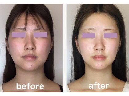 ビジュー(bijoux)の写真