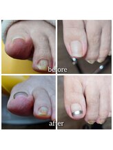 爪切り屋 足楽/