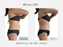 クライオ360(Cryo360)
