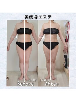 ラエッセス(A Laessess)/4ヶ月での変化