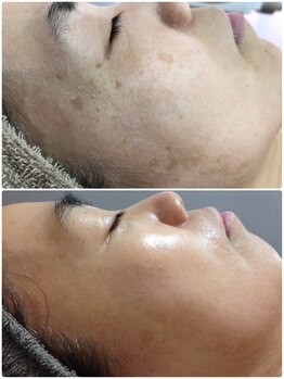 ルノン(LUNON)/全部一緒にケアできます♪