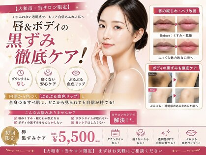 ミナミの写真