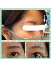 美眉アンド美肌専門サロンすみれ/ビフォアフター