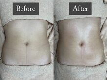 ベルフィーヌ 恵比寿店(BELFINE)/楽してボディメイク！