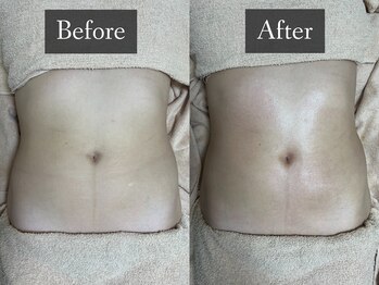 ベルフィーヌ 恵比寿店(BELFINE)/楽してボディメイク!