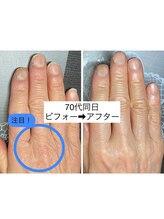 桃の木 吉祥寺店/ハンドケア＆ネイルケア