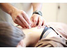 はりきゅう院 さくら/背中のこりケア