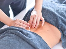 ヤマノ(YAMANO)/からだの美容鍼