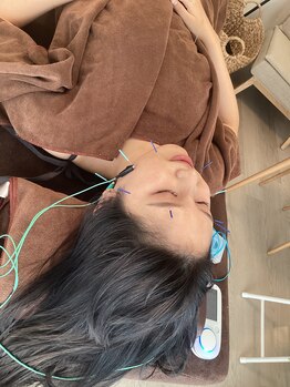 ハリファ鍼灸院 横浜関内院(HariFa鍼灸院)/美容施術