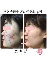 シエル(Ciel)/次世代レチノール《バクチ甦生》