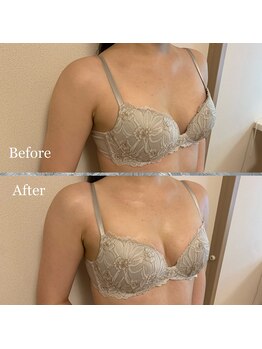 プリマベラ 大阪梅田(primabella)/１回目とのBeforeAfter