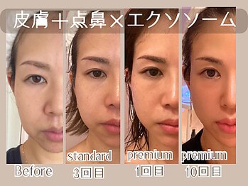 ナナイロ(nanairo)