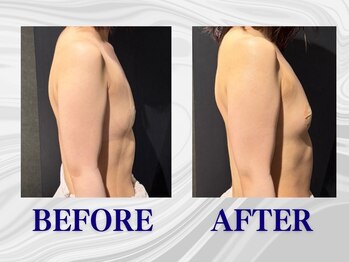 ザモア 福岡天神(THE MORE)/【症例 Before After】