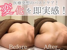 ナリッシュ バスト 六本木(Nouriche Bust)/バストアップはナリッシュバスト