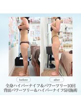 エスプレッソ(espresso,)/【二の腕】マイナス3センチ！！