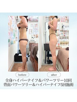 エスプレッソ(espresso,)/【二の腕】マイナス3センチ!!