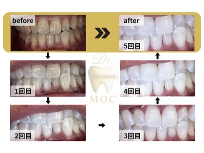 ドクターモック(Dr.MOC)の写真