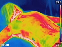 美人バスト 千早店/マシーン施術後の冷え改善→→