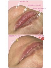 セレーノ(Sereno)/意外と見られて口元