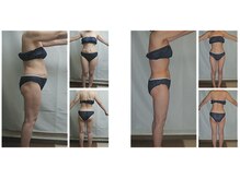 ミネルバエンダモロジー/エンダモロジー/痩身/ウェルネス