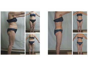 ミネルバエンダモロジー/エンダモロジー/痩身/ウェルネス