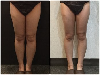 美容整体ウェリナ 名駅院/小顔矯正/骨盤矯正/美脚サロン