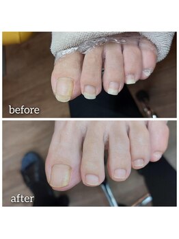 爪切り屋 足楽/